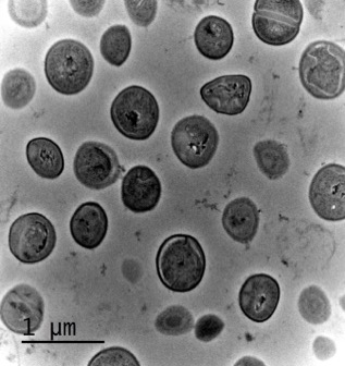 Colonia de bacterias sanas y sin estar en contacto con la zeolitas con Ag colonia de bacterias sanas o sin estar en contacto con la zeolitas con Ag