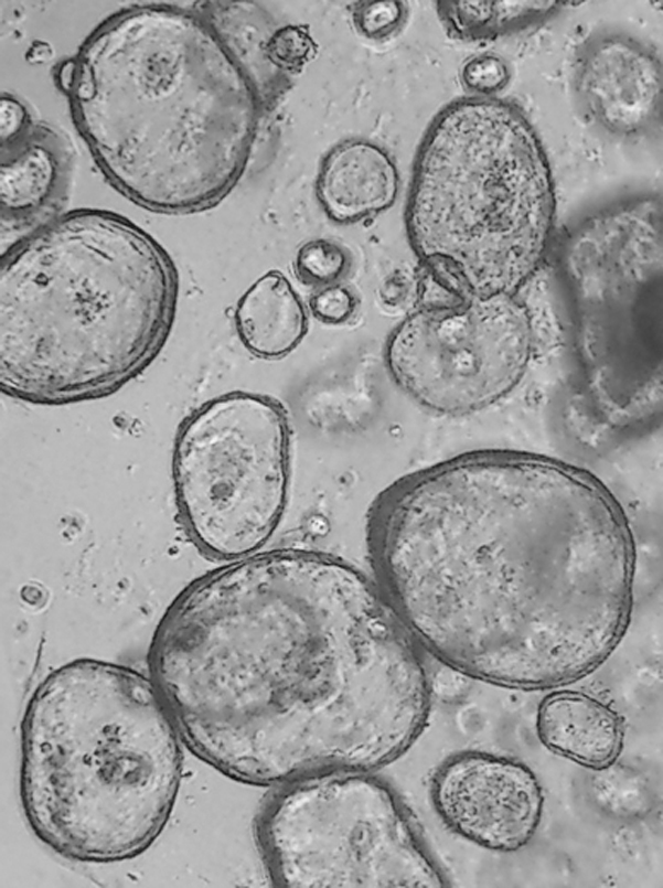 Criptas totalmente cerradas y formando organoides tras dos días de cultivo. colonia de bacterias sanas o sin estar en contacto con la zeolitas con Ag